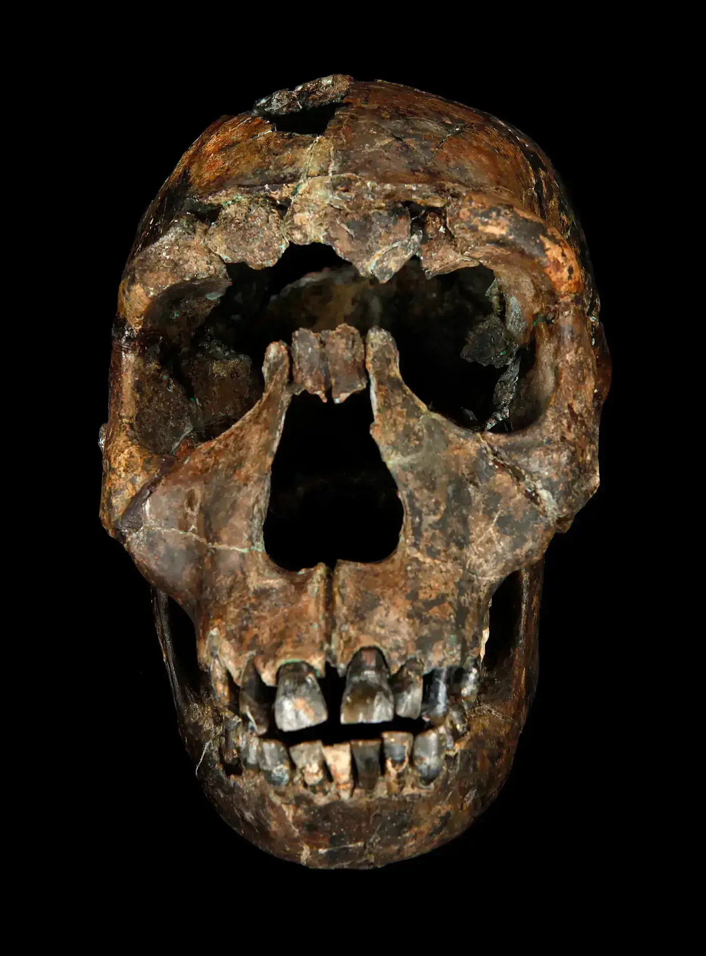 KNM-WT 15000 (Turkana Boy)